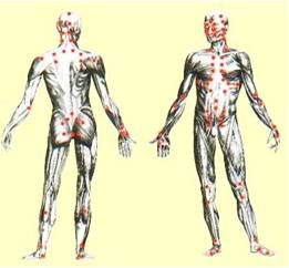 המרמות והטיפול בהן / טלי מסריק