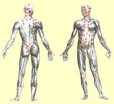 המרמות והטיפול בהן/ טלי מסריק